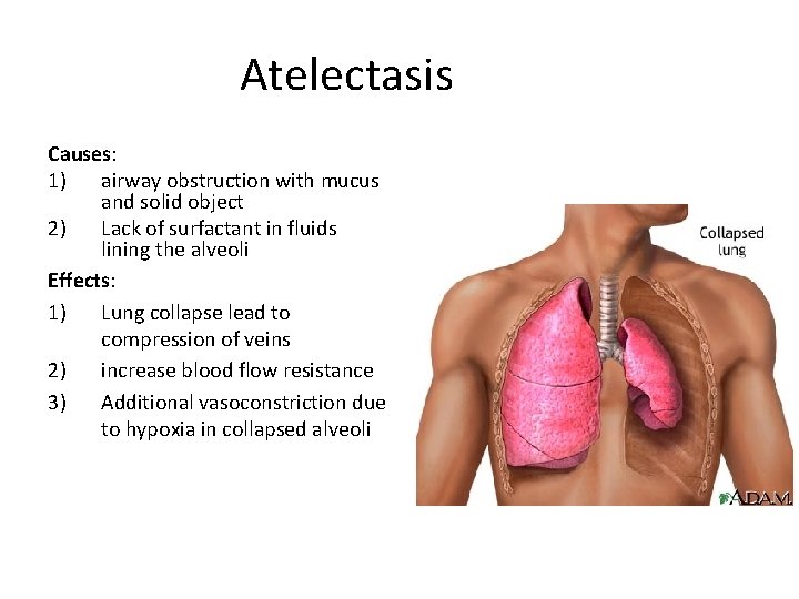 Atelectasis Causes: 1) airway obstruction with mucus and solid object 2) Lack of surfactant