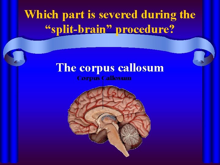 Which part is severed during the “split-brain” procedure? The corpus callosum 