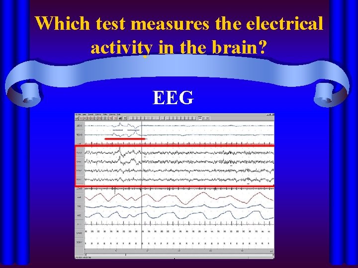 Which test measures the electrical activity in the brain? EEG 