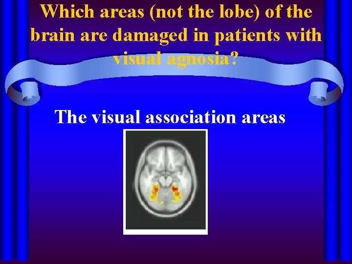 Which areas (not the lobe) of the brain are damaged in patients with visual