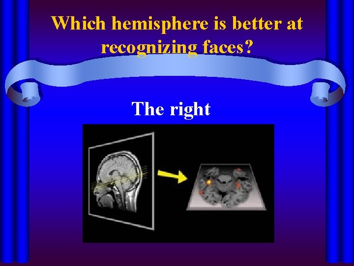 Which hemisphere is better at recognizing faces? The right 