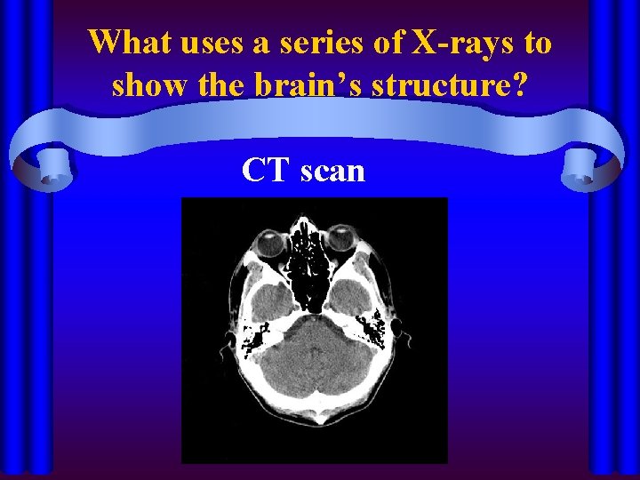 What uses a series of X-rays to show the brain’s structure? CT scan 