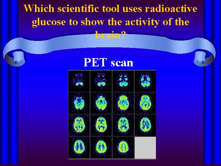 Which scientific tool uses radioactive glucose to show the activity of the brain? PET