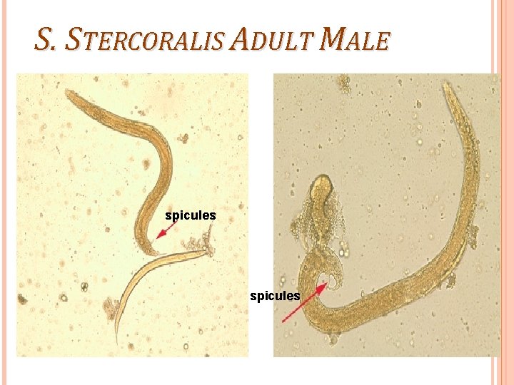 S. STERCORALIS ADULT MALE spicules 