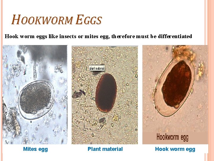 HOOKWORM EGGS Hook worm eggs like insects or mites egg, therefore must be differentiated
