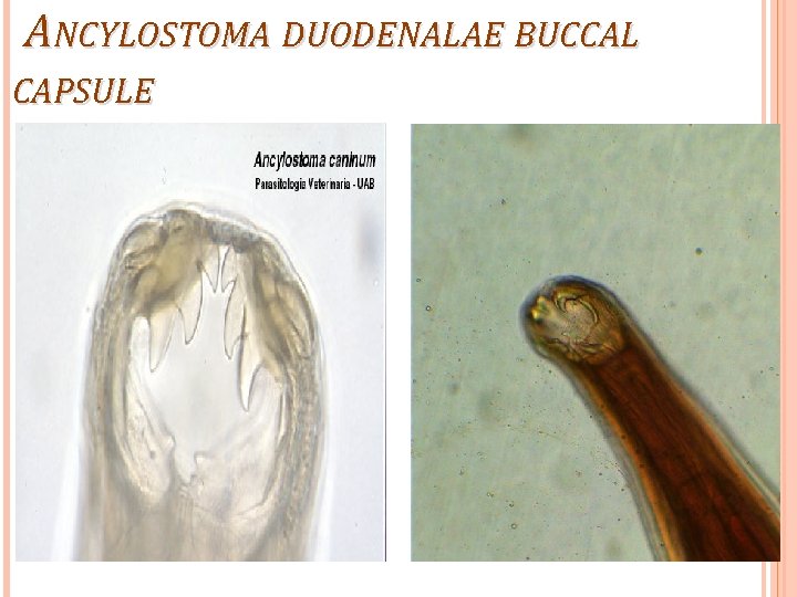 ANCYLOSTOMA DUODENALAE BUCCAL CAPSULE 