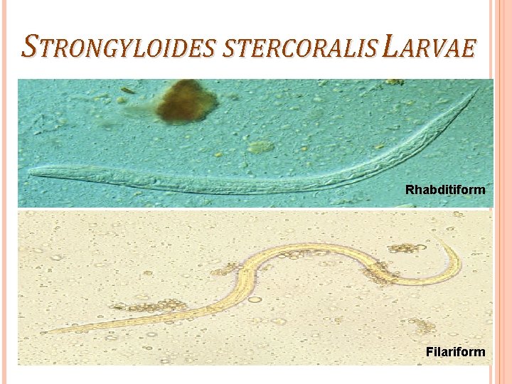 STRONGYLOIDES STERCORALIS LARVAE Rhabditiform Filariform 