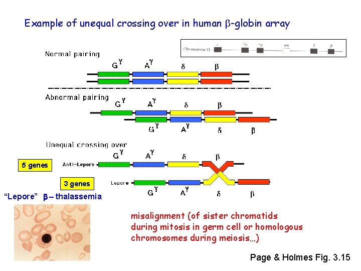 Example of unequal crossing over in human b-globin array 5 genes 3 genes “Lepore”