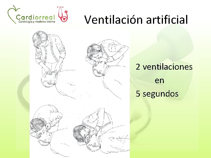 Ventilación artificial 2 ventilaciones en 5 segundos 