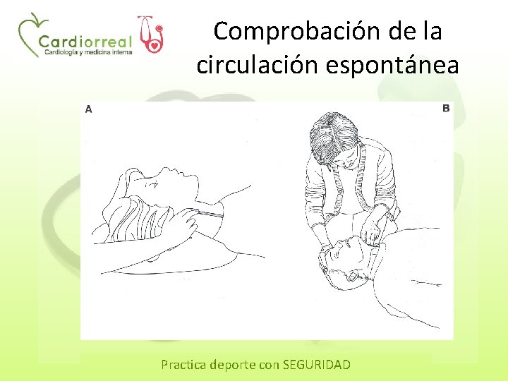 Comprobación de la circulación espontánea Practica deporte con SEGURIDAD 
