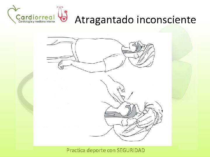 Atragantado inconsciente Practica deporte con SEGURIDAD 