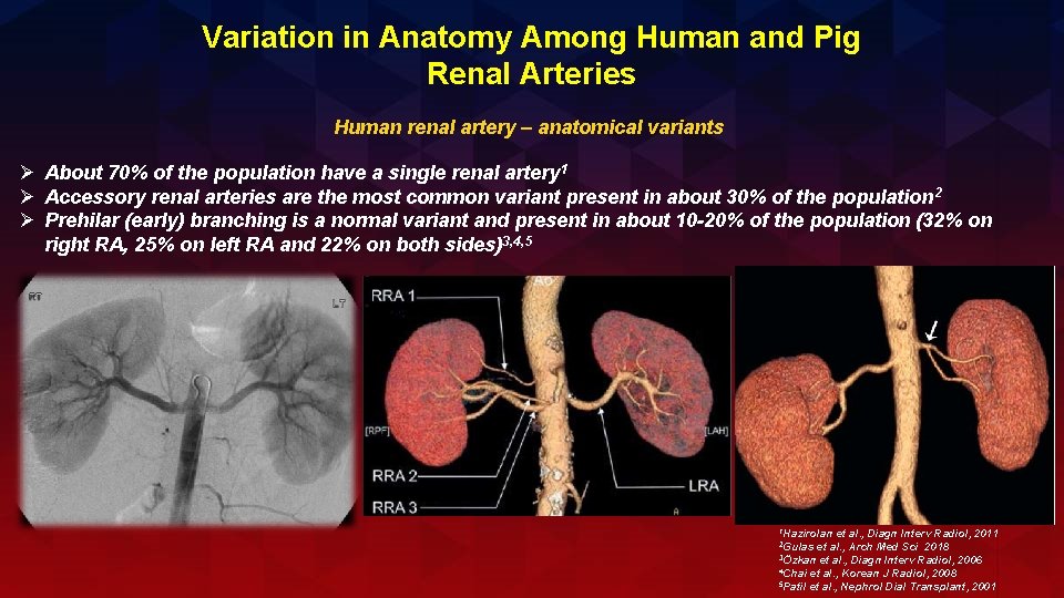Variation in Anatomy Among Human and Pig Renal Arteries Human renal artery – anatomical