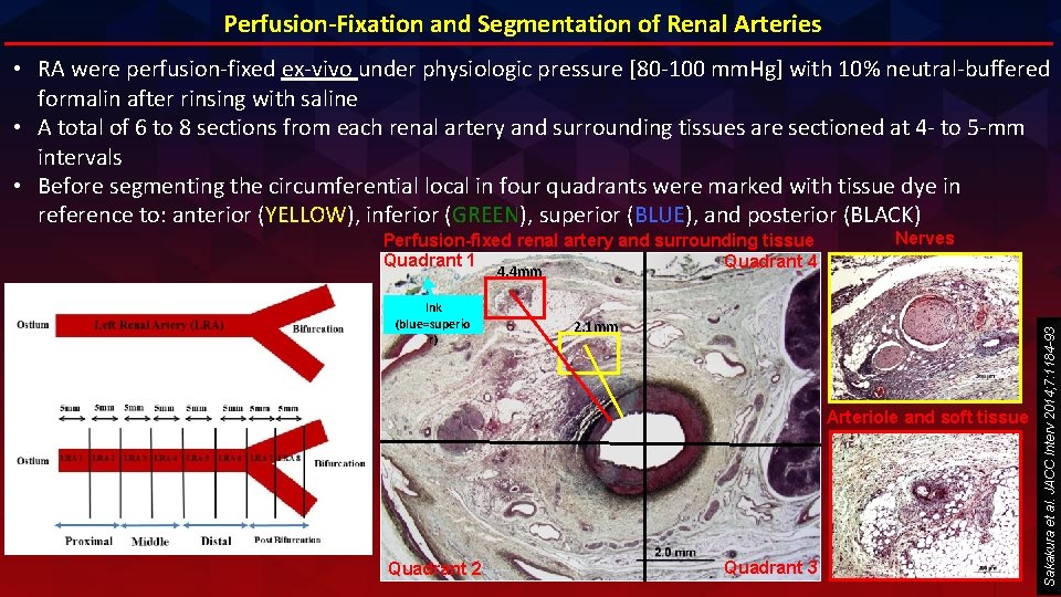 Perfusion-Fixation and Segmentation of Renal Arteries • RA were perfusion-fixed ex-vivo under physiologic pressure