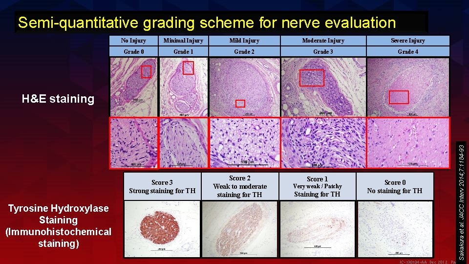 Semi-quantitative grading scheme for nerve evaluation No Injury Minimal Injury Mild Injury Moderate Injury