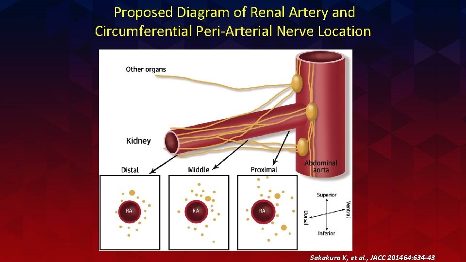 Proposed Diagram of Renal Artery and Circumferential Peri-Arterial Nerve Location Sakakura K, et al.