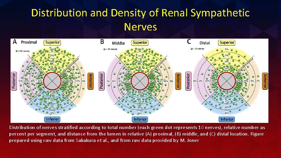 Distribution and Density of Renal Sympathetic Nerves Distribution of nerves stratified according to total