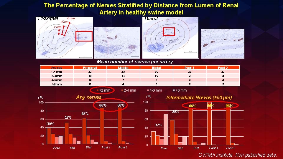 The Percentage of Nerves Stratified by Distance from Lumen of Renal Artery in healthy