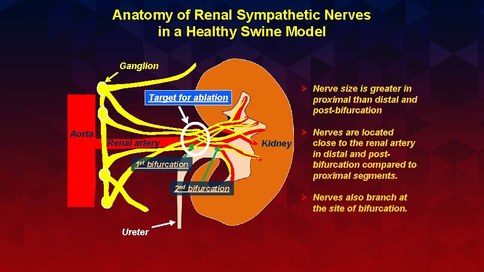 Anatomy of Renal Sympathetic Nerves in a Healthy Swine Model Ganglion Ø Nerve size
