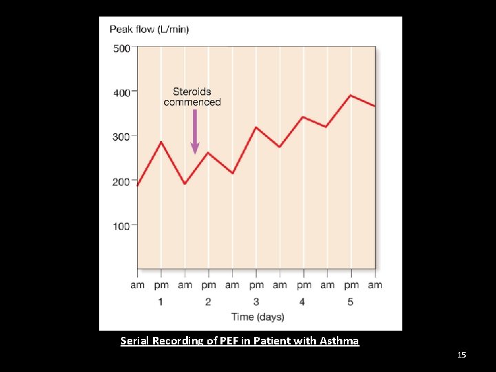 Serial Recording of PEF in Patient with Asthma 15 