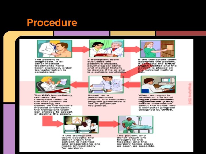 Procedure 