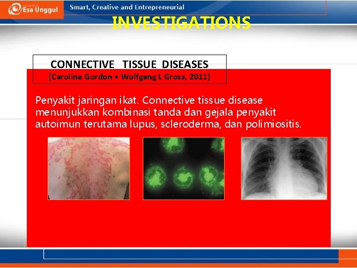 INVESTIGATIONS CONNECTIVE TISSUE DISEASES (Caroline Gordon • Wolfgang L Gross, 2011) Penyakit jaringan ikat.