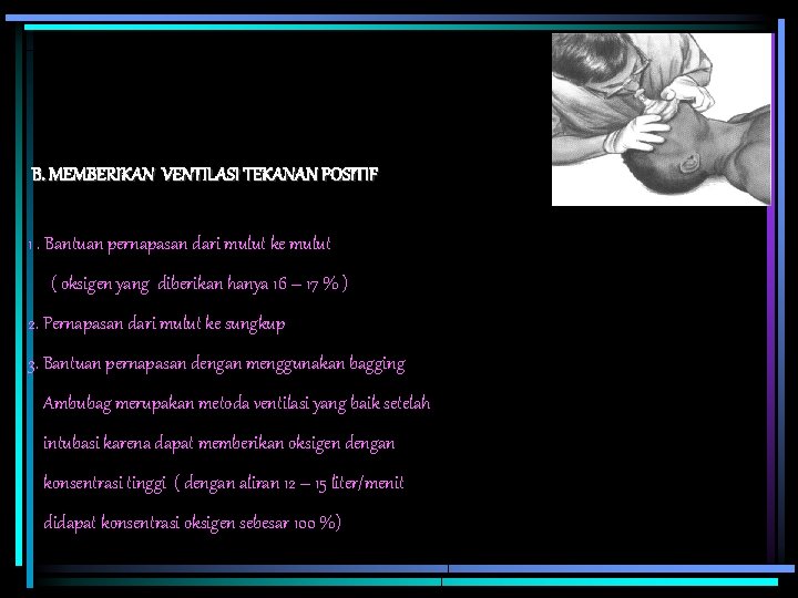 B. MEMBERIKAN VENTILASI TEKANAN POSITIF 1. Bantuan pernapasan dari mulut ke mulut ( oksigen