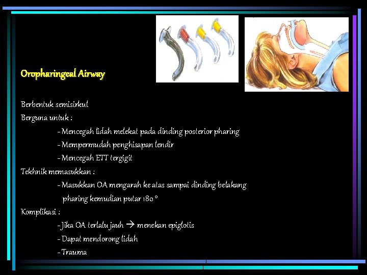 Oropharingeal Airway Berbentuk semisirkul Berguna untuk : - Mencegah lidah melekat pada dinding posterior