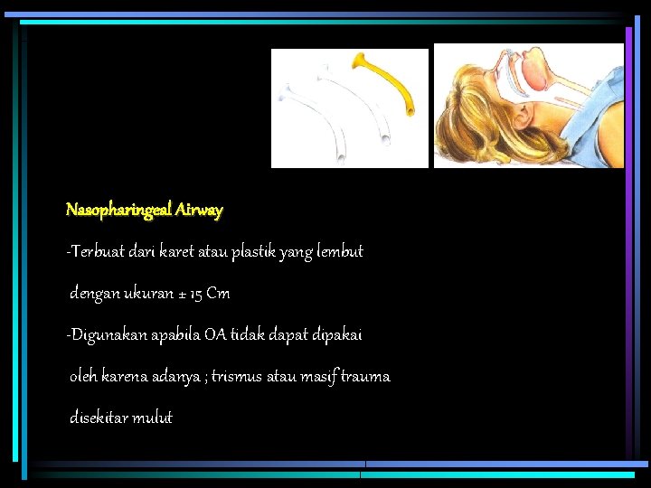 Nasopharingeal Airway -Terbuat dari karet atau plastik yang lembut dengan ukuran ± 15 Cm