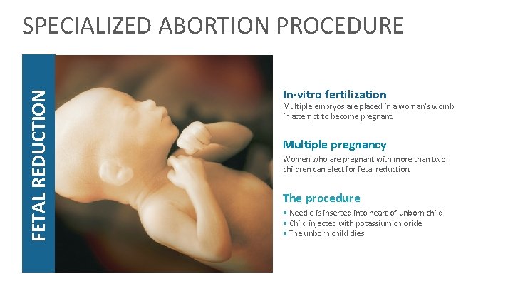 FETAL REDUCTION SPECIALIZED ABORTION PROCEDURE In-vitro fertilization Multiple embryos are placed in a woman’s