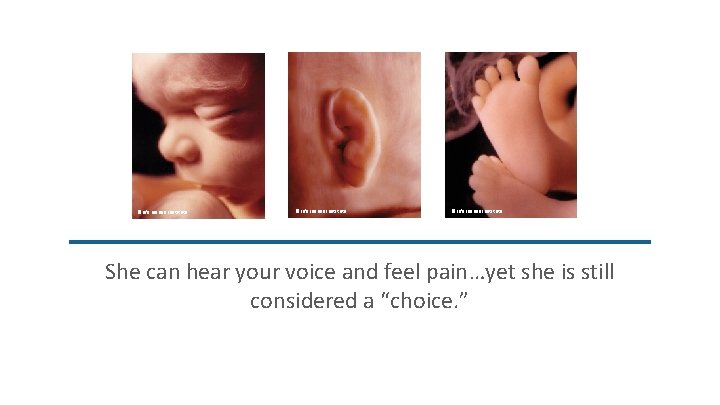 ©Life Issues Institute She can hear your voice and feel pain…yet she is still