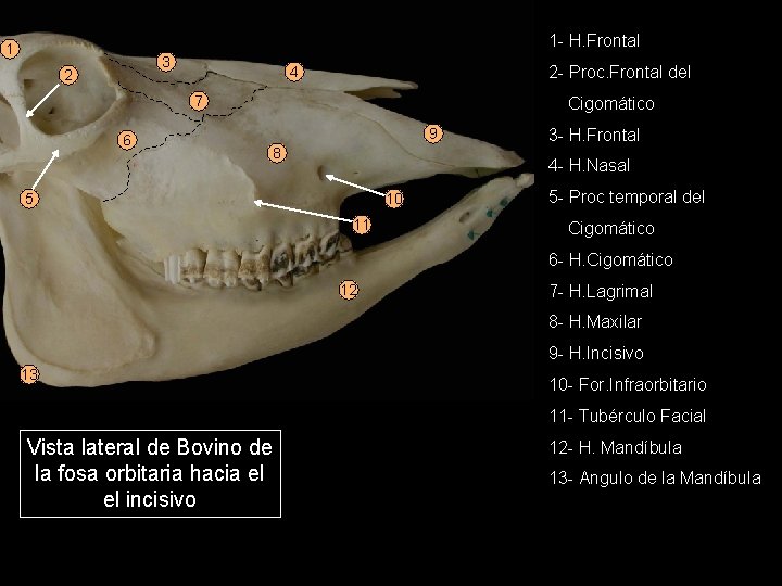 1 - H. Frontal 1 3 2 2 - Proc. Frontal del 4 7