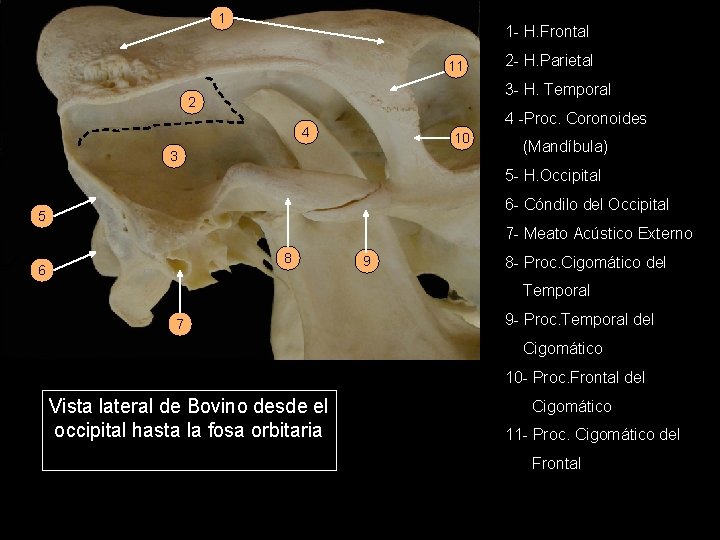 1 1 - H. Frontal 11 2 - H. Parietal 3 - H. Temporal