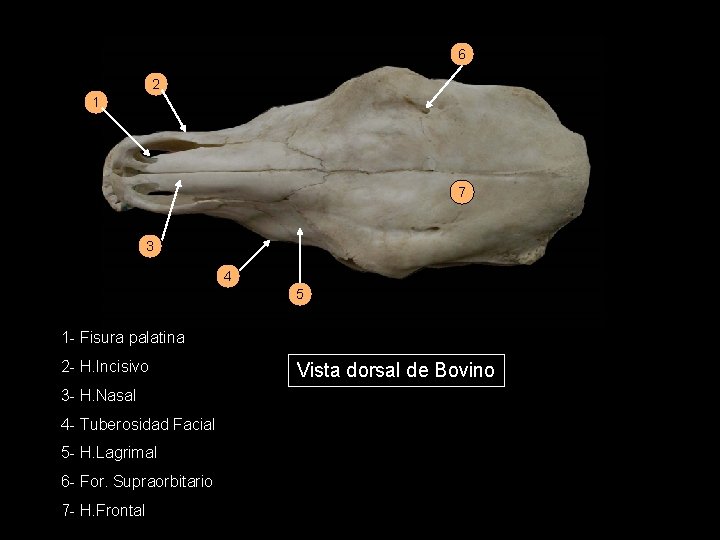 6 2 1 7 3 4 5 1 - Fisura palatina 2 - H.