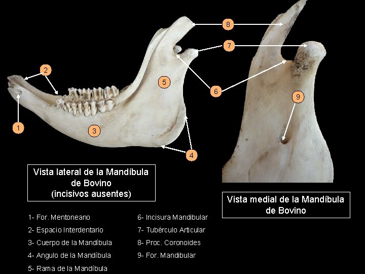 8 7 2 5 6 1 9 3 4 Vista lateral de la Mandíbula