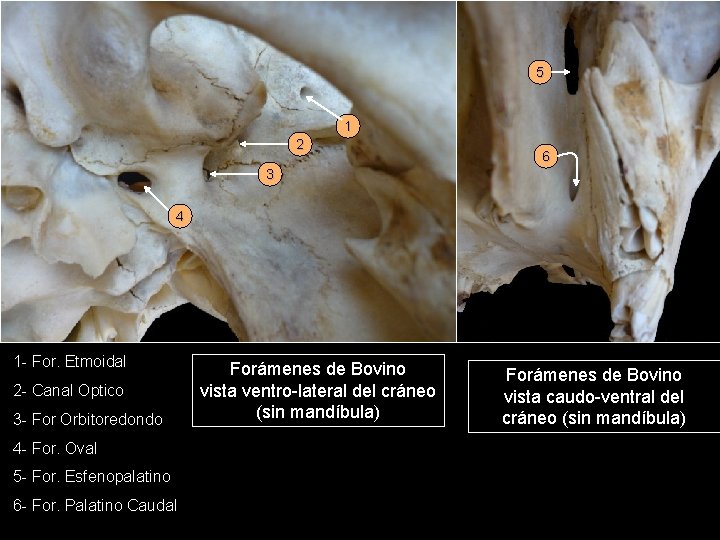 5 1 2 6 3 4 1 - For. Etmoidal 2 - Canal Optico