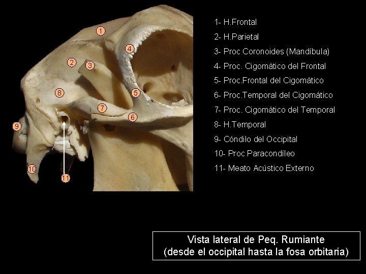 1 - H. Frontal 1 2 - H. Parietal 4 2 3 - Proc