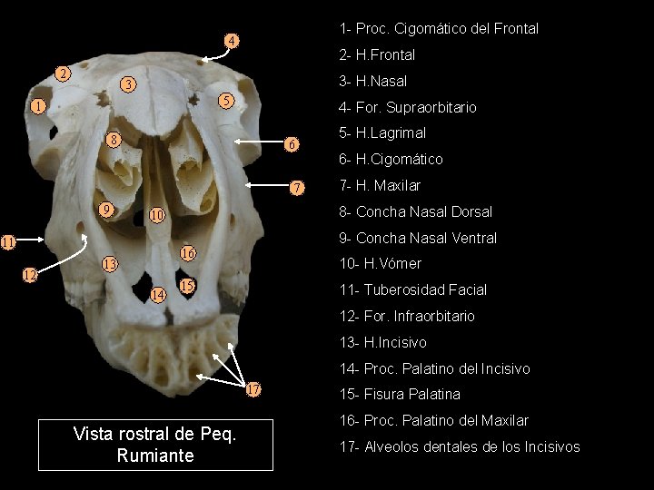 1 - Proc. Cigomático del Frontal 4 2 2 - H. Frontal 3 -