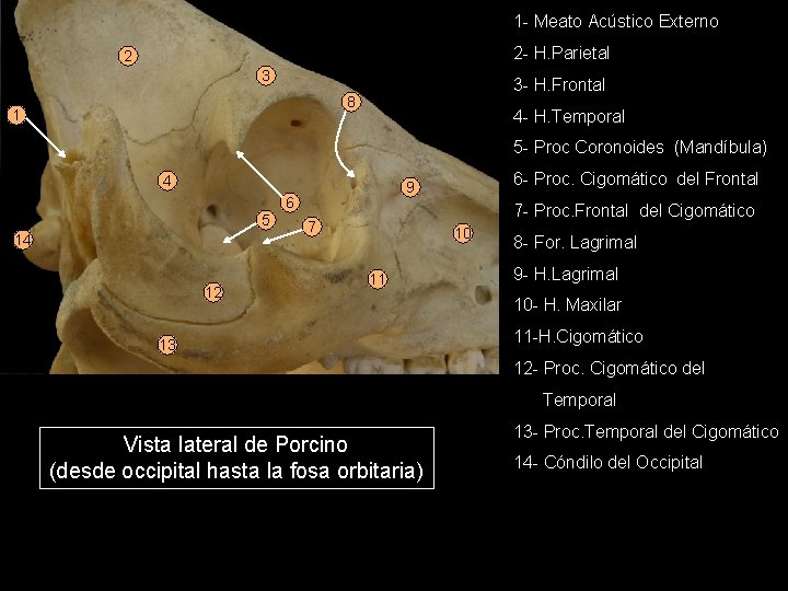 1 - Meato Acústico Externo 2 - H. Parietal 2 3 3 - H.