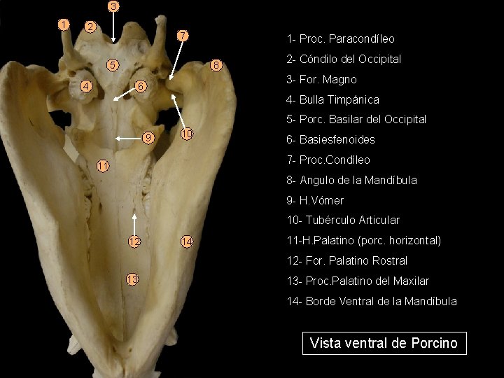 3 1 2 7 5 1 - Proc. Paracondíleo 8 4 2 - Cóndilo