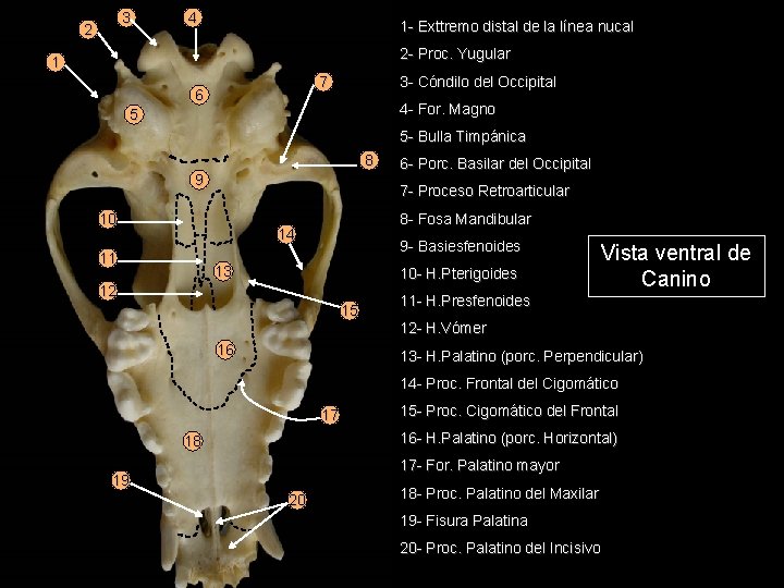 3 2 4 1 - Exttremo distal de la línea nucal 2 - Proc.