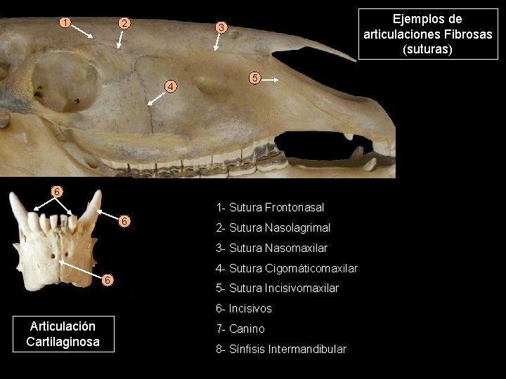 1 2 Ejemplos de articulaciones Fibrosas (suturas) 3 4 5 6 1 - Sutura