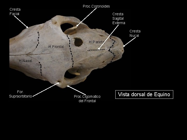 Proc. Coronoides Cresta Facial Cresta Sagital Externa Cresta Nucal H. Parietal H. Frontal H.