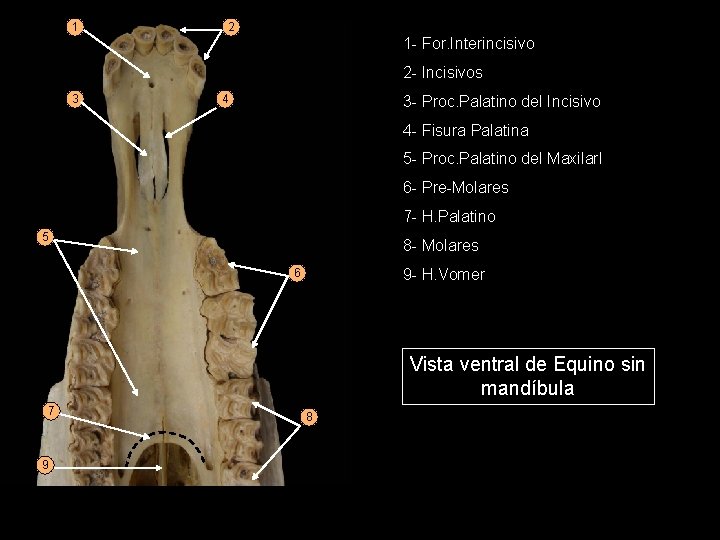 1 2 1 - For. Interincisivo 2 - Incisivos 3 3 - Proc. Palatino