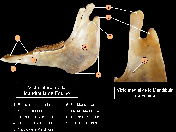 9 8 7 1 4 3 6 2 5 Vista lateral de la Mandíbula