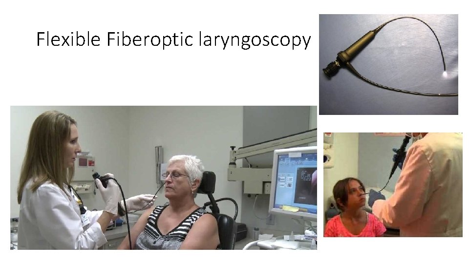 Anatomy of the larynx and benign lesions of
