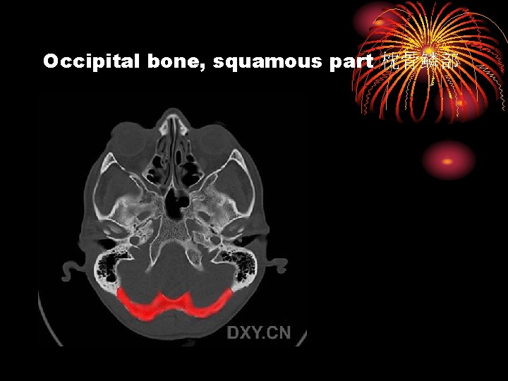 Occipital bone, squamous part 枕骨鳞部 