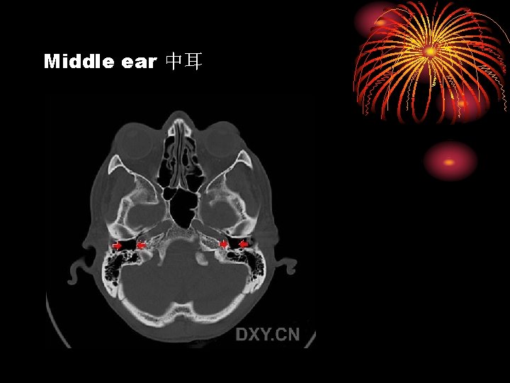 Middle ear 中耳 