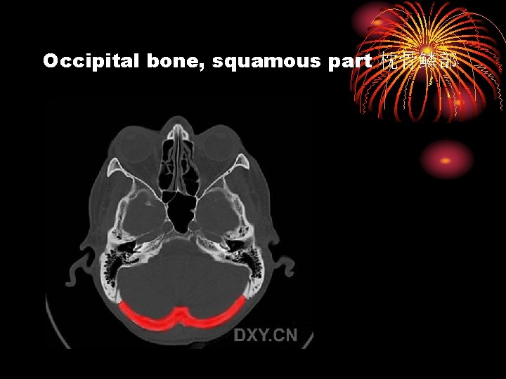 Occipital bone, squamous part 枕骨鳞部 