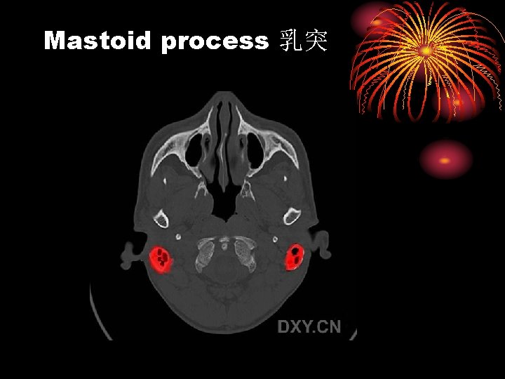 Mastoid process 乳突 