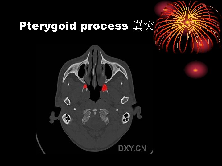 Pterygoid process 翼突 